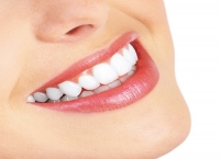 牙齿美白有哪些方式？树脂美白、贴面美白和全冠各有哪些优缺点？